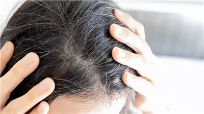 مضاد الأكسدة الرئيسي قد يساعد في منع الشيب المبكر.. تعرّف عليه ومصادره الغذائية