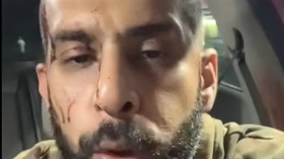 الأمن يفحص فيديو التعدي على سائق أوبر بالصحراوي في الجيزة لمحاولة سرقته