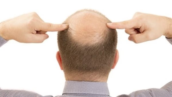  صورة تعبيرية 