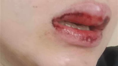 كسر أسنانها وشوّه وجهها.. ضبط زوج اعتدى على طليقته في الشارع بسبب خلاف على رؤية طفلتهما ببورسعيد| صور 