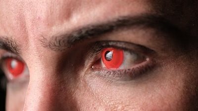 أضرار استخدام العدسات اللاصقة الملونة 