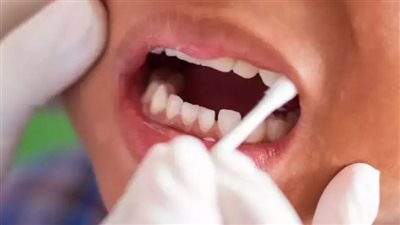 لماذا حذرت أمريكا من أدوية مادة الفلورايد للأطفال؟.. تفاصيل 