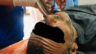 إنقاذ صياد ابتلع “سمكة بلطي” عن طريق الخطأ في بني سويف (صور)