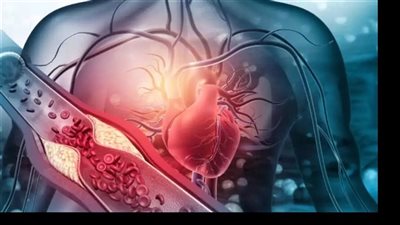 تغييرات بسيطة في نمط الحياة تحمي من الإصابة بالنوبات القلبية