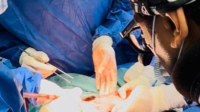 لأول مرة.. استئصال ورم يزن 6 كيلو لسيدة خمسينية في مستشفى ببورسعيد