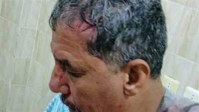 مشاجرة شباب بالأسلحة البيضاء.. وإصابة رجل ونجله خلال محاولتهما التفريق بينهم بالشرقية