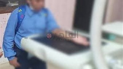 مدرس يكسر يد طالب ابتدائي بإحدى المدارس الخاصة في الفيوم