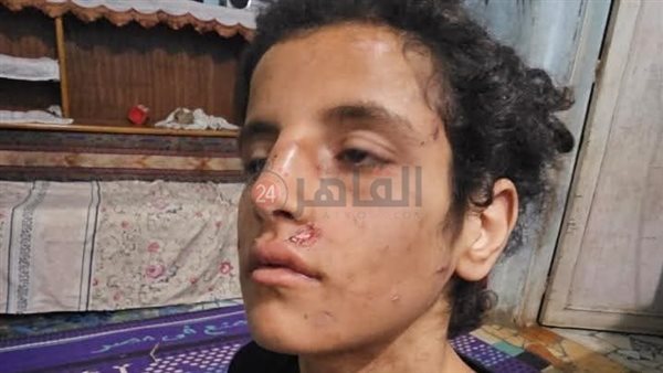 صغيرة المنوفية ضحية