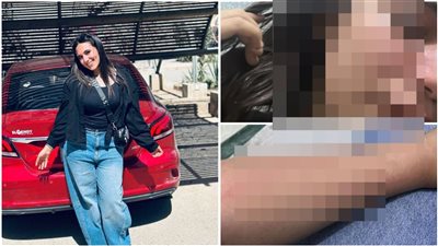 رفضت تتجوزه.. أسرة تستغيث بعد تعرض ابنتهم للضرب والاعتداء من شخص تقدم لزواجها مسبقًا بالجيزة