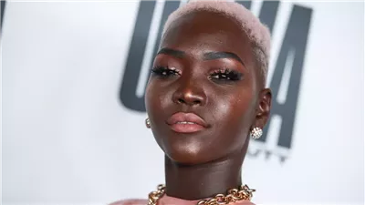أعادت تعريف معايير الجمال عالميًا.. من هي عارضة الأزياء الجنوب سودانية الأمريكية نياكيم جاتويش؟