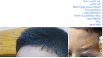 اتخاذ الإجراءات القانونية ضد مدرس اعتدى على طالب بعصا خشبية في مدرسة بدمياط