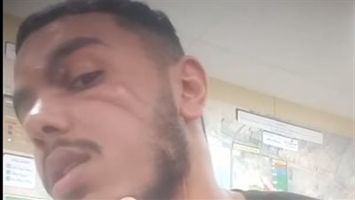 الأمن يفحص فيديو لطالب يزعم الاعتداء عليه في شارع الهرم وإصابته بجروح نافذة