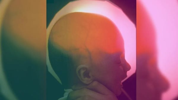 صورة تعبيرية