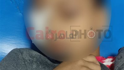 أصيب داخل مدرسة.. تلميذ قنا يُجري عملية جراحية دقيقة في عينه داخل مستشفى الجامعة بسوهاج