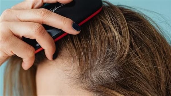 فروة الرأس ـ تعبيرية