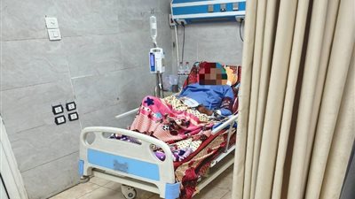  إنقاذ سيدة من عضة ثعبان بـ 42 جرعة مصل في سوهاج