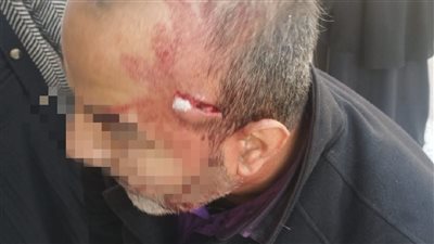 القبض على شخص اقتحم مدرسة بالإسماعيلية واعتدى على معلم بالمقص