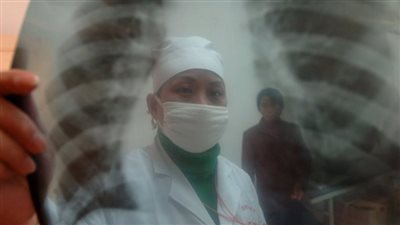 دراسة تحذر: الأورام الليفية الرحمية قد ترفع خطر الإصابة بأمراض القلب لدى النساء