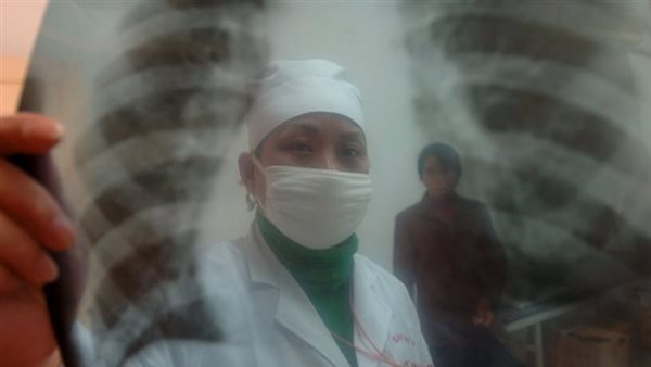  صورة تعبيرية 