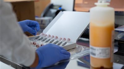 مصر تصبح سادس دولة في العالم تحقق الاكتفاء الذاتي من البلازما