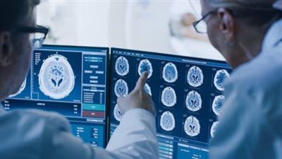 دراسة: عادات نمط الحياة الإيجابية تؤخر شيخوخة الدماغ بمقدار 8 سنوات 