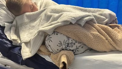 تبلغ 21 عاما.. التدخين الإلكتروني يتسبب في إصابة فتاة بريطانية بسرطان الرئة