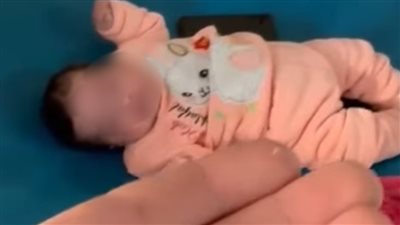 ابتلعت جزءًا من ولاعة.. إنقاذ رضيعة من اختناق تنفسي داخل مستشفى بالمنوفية 