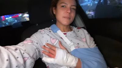 إصابة ناهد السباعي بكسر في الذراع (صورة)