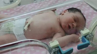 العثور على طفلة حديثة الولادة وسط القمامة بشبين القناطر 