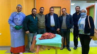 رئيس جامعة أسيوط: نجاح عملية استئصال ورم لمريض بوزن 30 كجم
