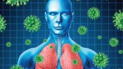 الالتهاب الرئوي أكثر فتكاً من كوفيد-19 (دراسة)