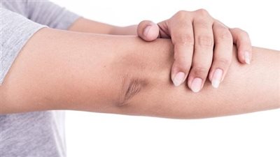 طرق التخلص من البقع الداكنة بالجسم