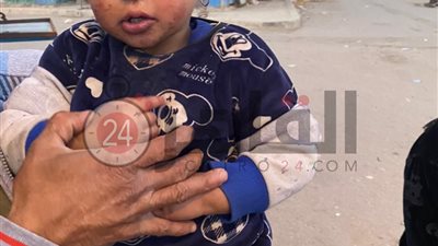 رضيعة أكتوبر تعاني من مرض خطير.. ونفقة العلاج تعجّز أسرتها (فيديو)