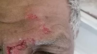 إصابة فني تكييف بالسكة الحديد بعد رشق قطار الصعيد بالحجارة