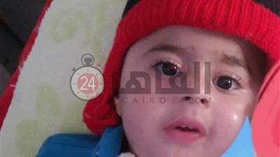 منذ مولده.. طفل يعيش في العناية المركزة بحالة ضمور نادرة.. ومدير المستشفى: والداه يمثلان قصة بطولة