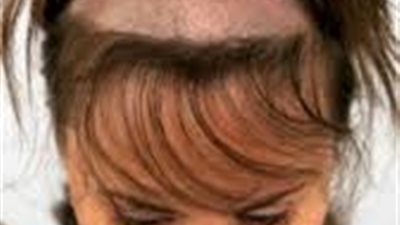 فتاة أمريكية تقع في ورطة بعد محاولتها لتثبيت شعرها (فيديو)