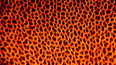 تعرف على فوبيا الثقوب وأعراضها وطرق علاجها