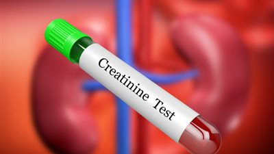 تعرّف على المعدل الطبيعي للكرياتينين في الجسم وإليك 8 علاجات منزلية لتقليله 