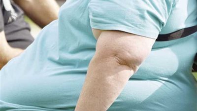 9 من كل 10 وفيات بفيروس كورونا يعانون من السمنة (دراسة)