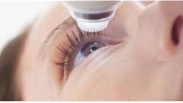 عملية تصحيح البصر