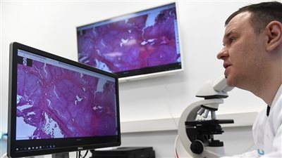 طبيب روسي: 7 فيروسات تتسبب في الإصابة بالسرطان