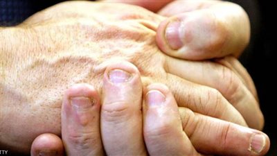 تعرف على أعراض وعلامات نقص الفيتامينات بالجسم