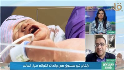  ارتفاع غير مسبوق في إنجاب التوائم حول العالم (تقرير)