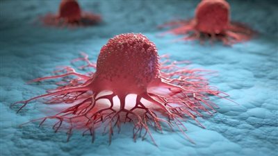 5 أطعمة تسبب الإصابة بالسرطان احذرها