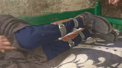 مُصاب بسرطان العظام.. الفقر والمرض يُحاصران شاب وأسرته في سوهاج (صور)