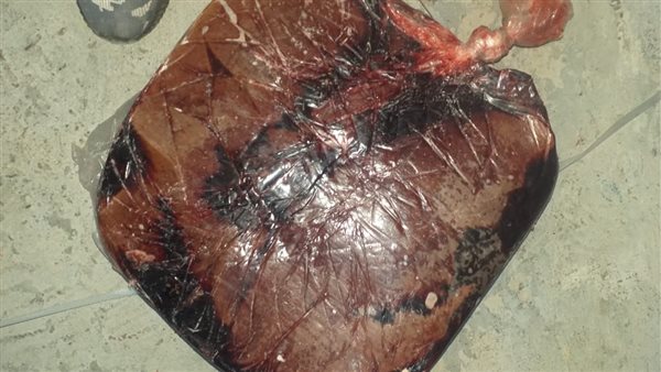 ضبط كبدة فاسدة