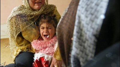 طبيب بقصر العيني: لا يوجد في الطب ما يسمى ختان الإناث.. وما يحدث تشويه للأعضاء الجنسية