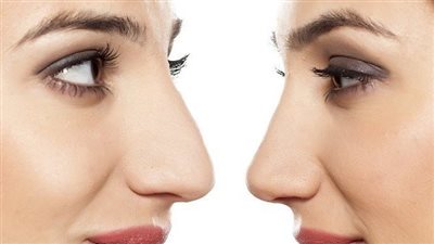 كيف تجعلين شكلك أصغر بدون عمليات تجميل؟