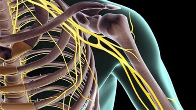 الضفيرة العضدية.. أبرز المعلومات عنها وطرق علاجها 