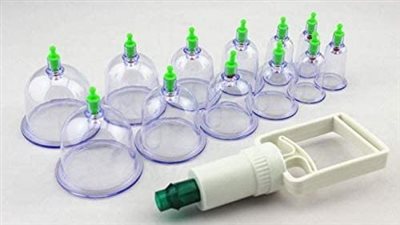 على الرغم من فوائدها العديدة.. ما هي أضرار الحجامة على النساء؟